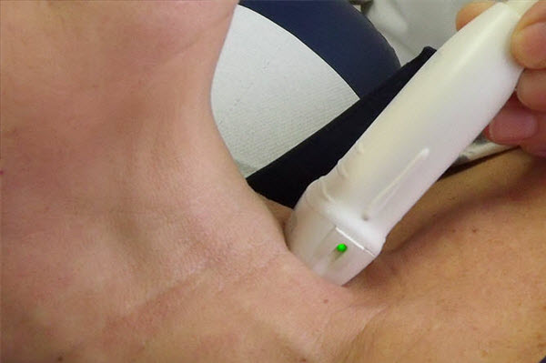 Ultraschall der Schilddrüse