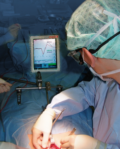 Abbildung kontinuierliche Neuromonitoring