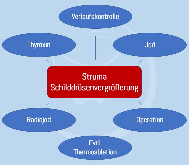 Behandlungsmöglichkeiten Struma