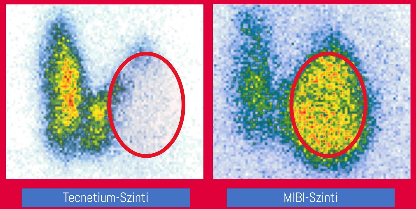 Darstellung Mismatch
